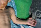 Mãe é presa em MT suspeita de bater em bebê e usar maquiagem em hematomas