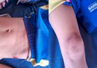 Jovem sem CNH atropela criança e foge sem prestar socorro em Barra do Garças