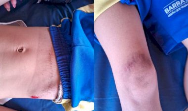 Jovem sem CNH atropela criança e foge sem prestar socorro em Barra do Garças