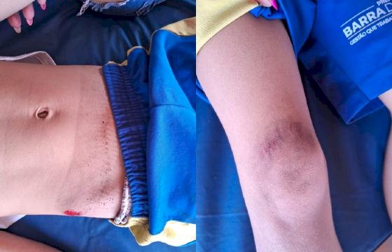 Jovem sem CNH atropela criança e foge sem prestar socorro em Barra do Garças